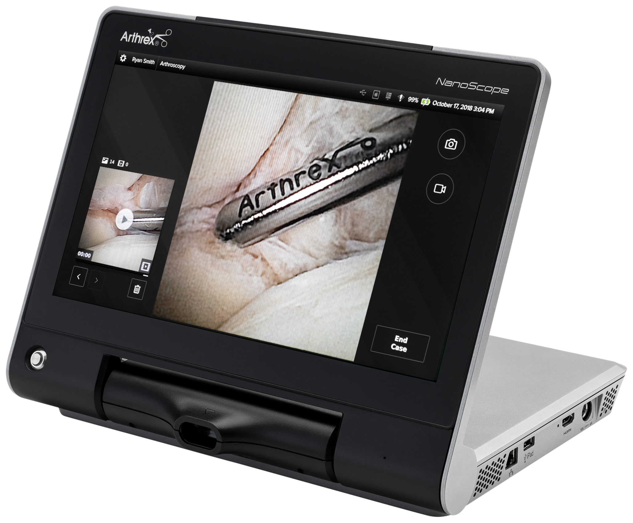 Arthrex - NanoScope Tablet Control Unit, Vet - VAR-3200-0030