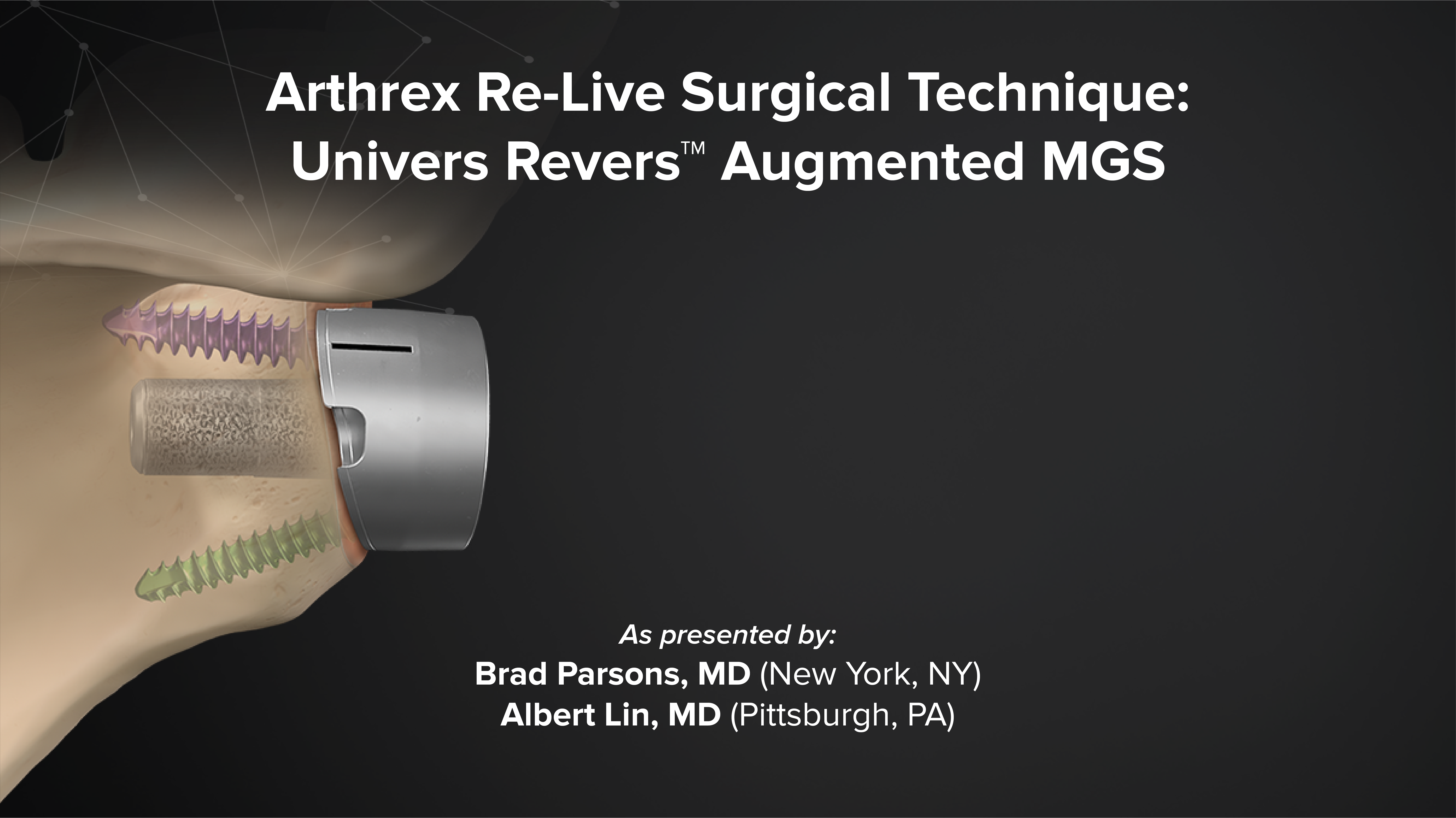 【SOULESURES x SURGERY】SS008 triangle Arthrex - Arthrex Re-Live Surgical Technique: Univers Revers