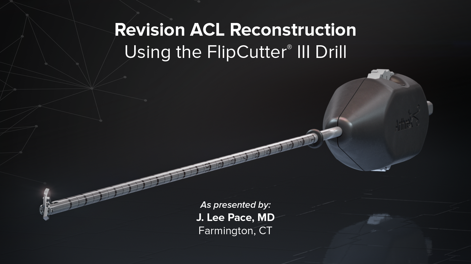 Arthrex - Revision ACL Reconstruction Using the FlipCutter