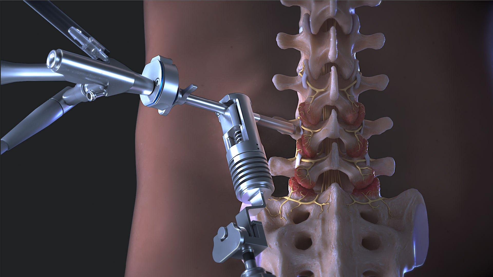 今日の整形外科治療指針 = Today's Therapy in Orthop… 今日の整形外科治療指針 = Today's Therapy in Orthop…（今日の