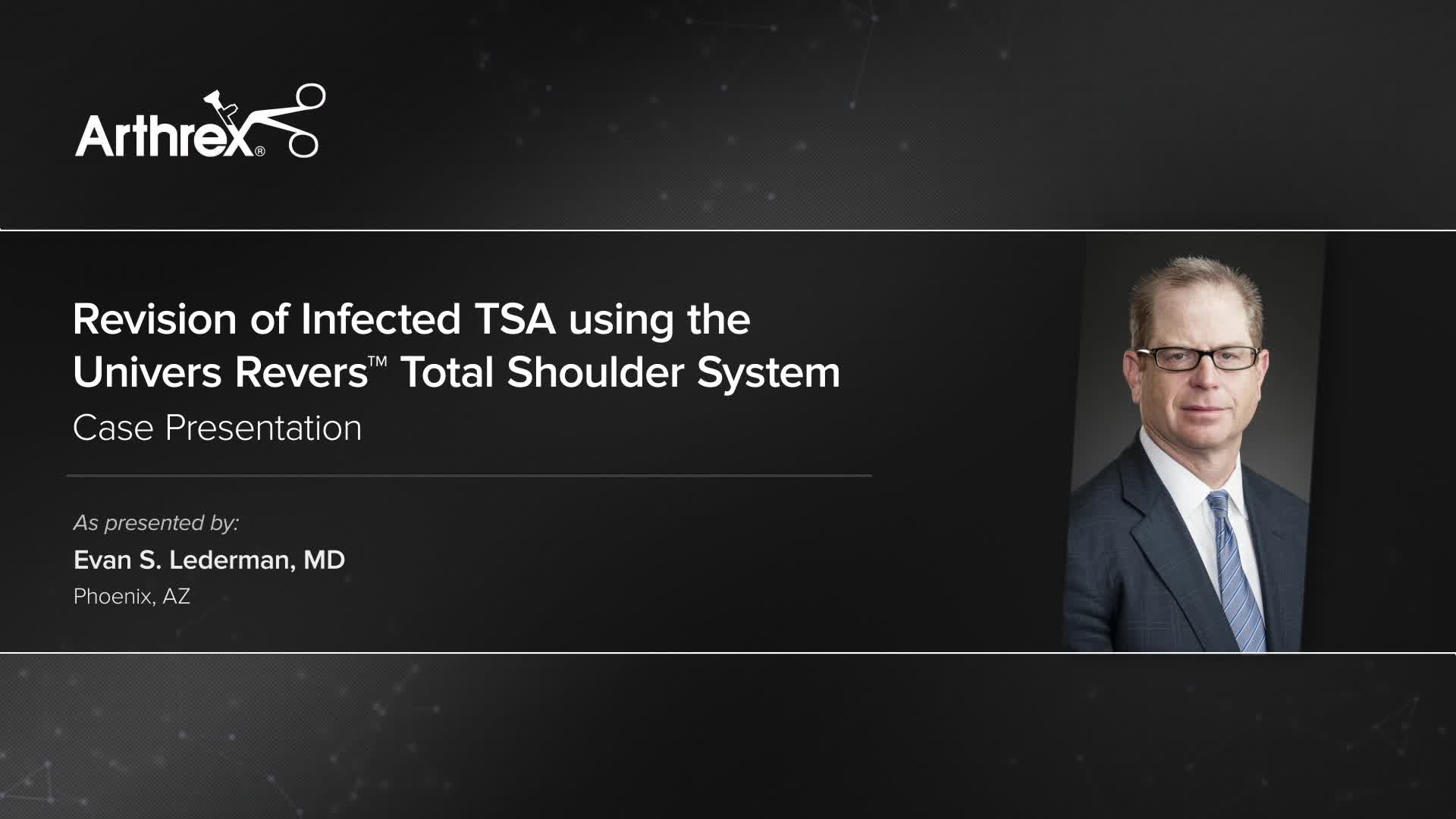 Arthrex Revision Of Infected Tsa Using The Univers Revers Total