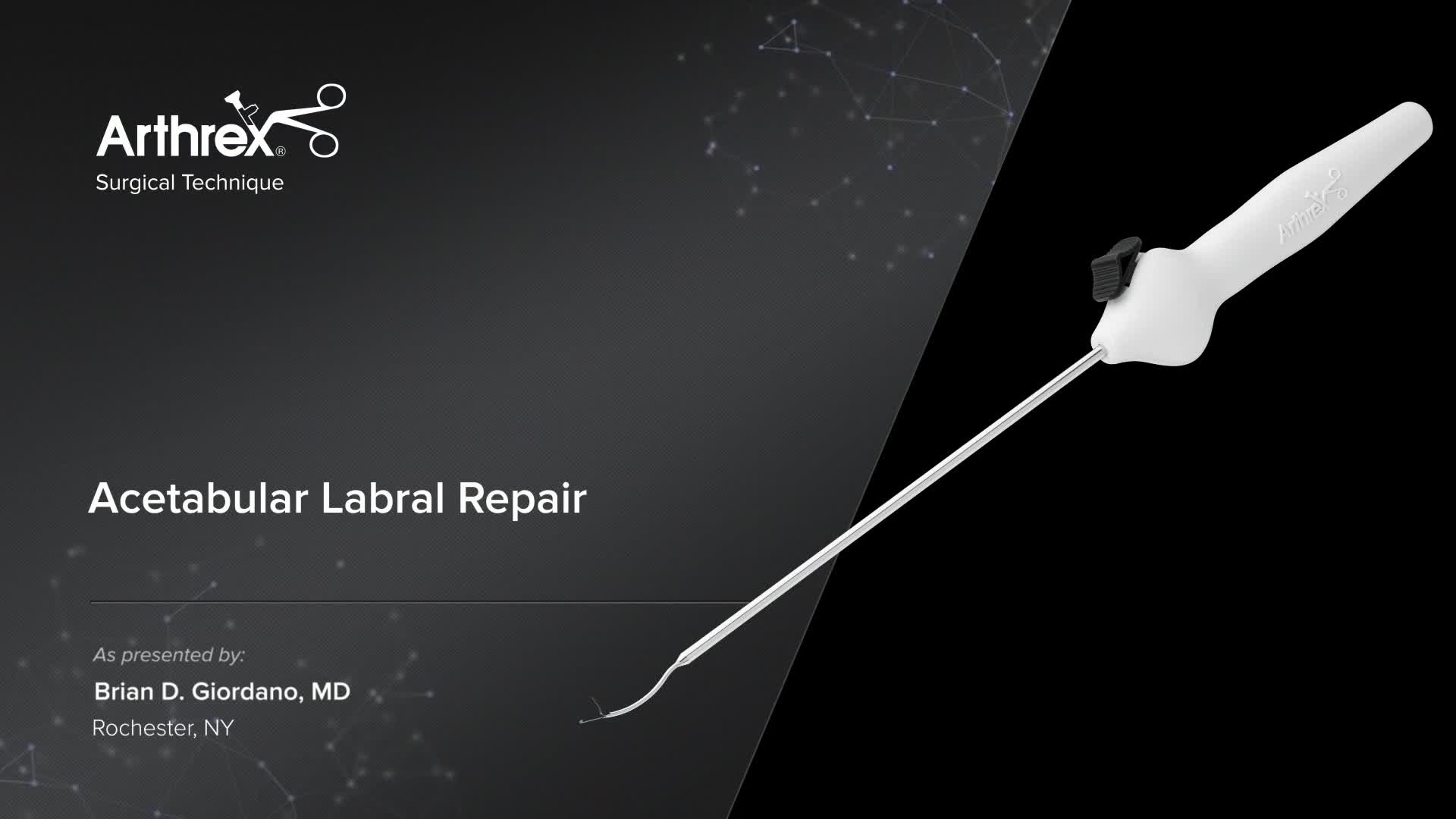 Arthrex Acetabular Labral Repair