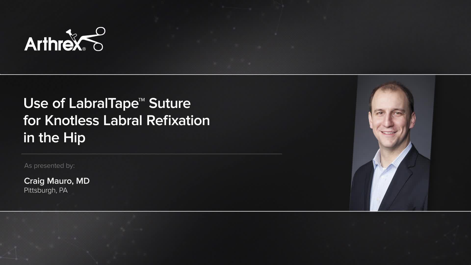 Arthrex Use Of LabralTape Suture For Knotless Labral Refixation In