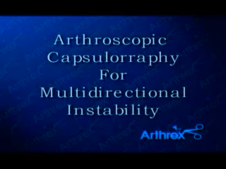 Arthrex Arthroscopic Capsulorraphy For Multi Directional Instability