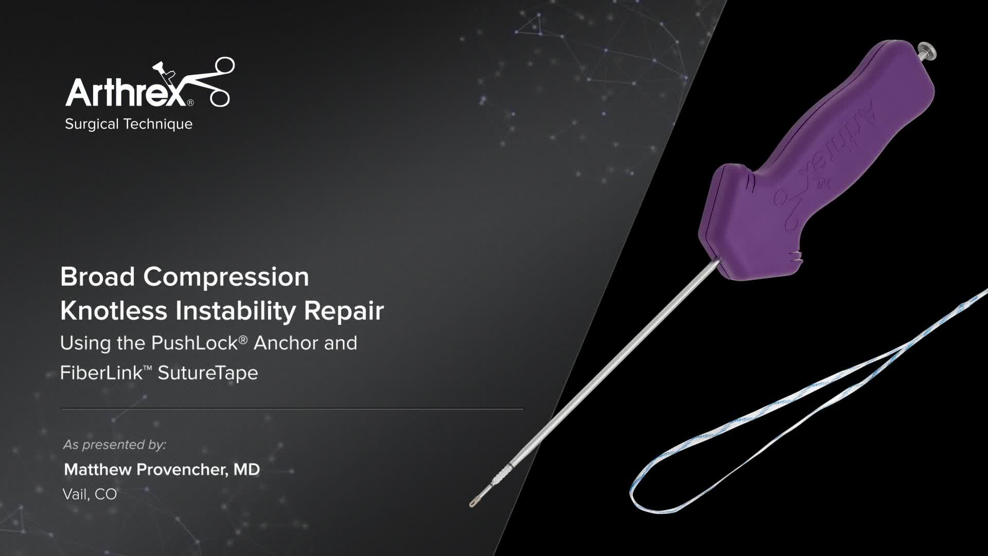 Arthrex Broad Compression Knotless Instability Repair Using The