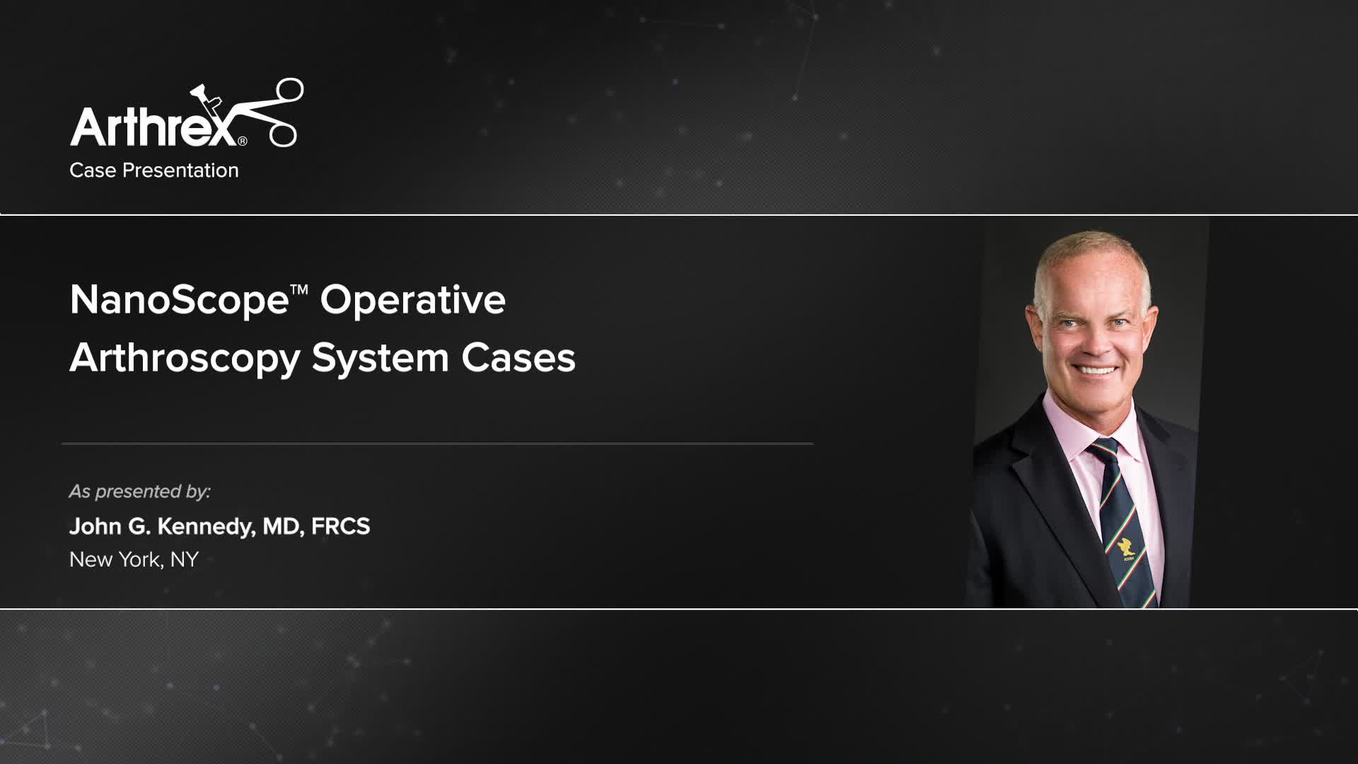 Arthrex Nanoscope Operative Arthroscopy System Cases