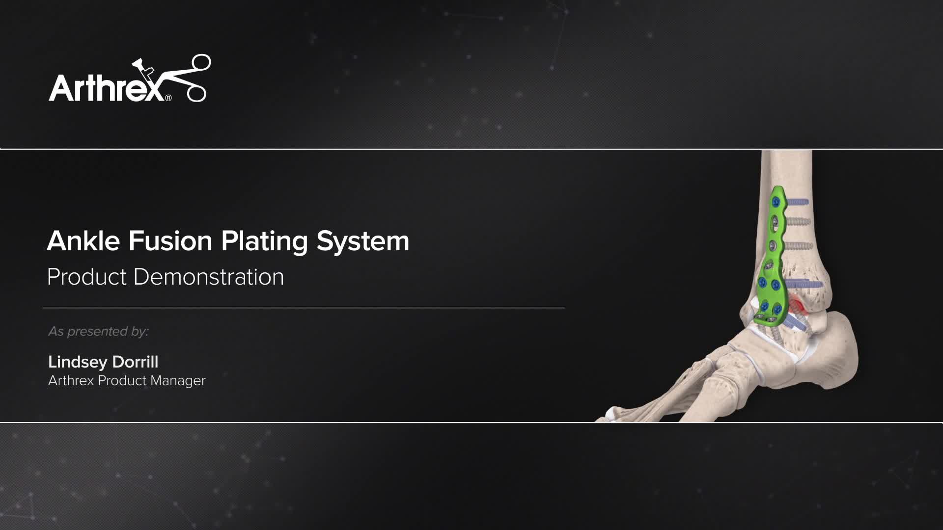 Arthrex Ankle Fusion Plating System