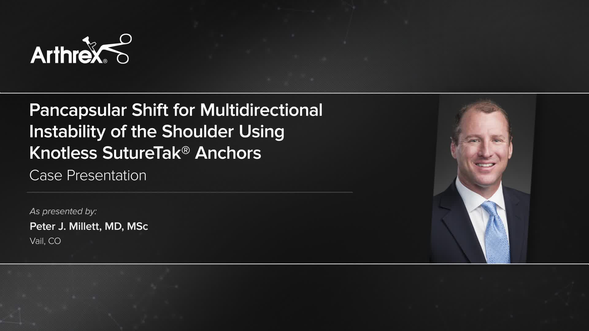 Arthrex Pancapsular Shift For Multidirectional Instability Of The