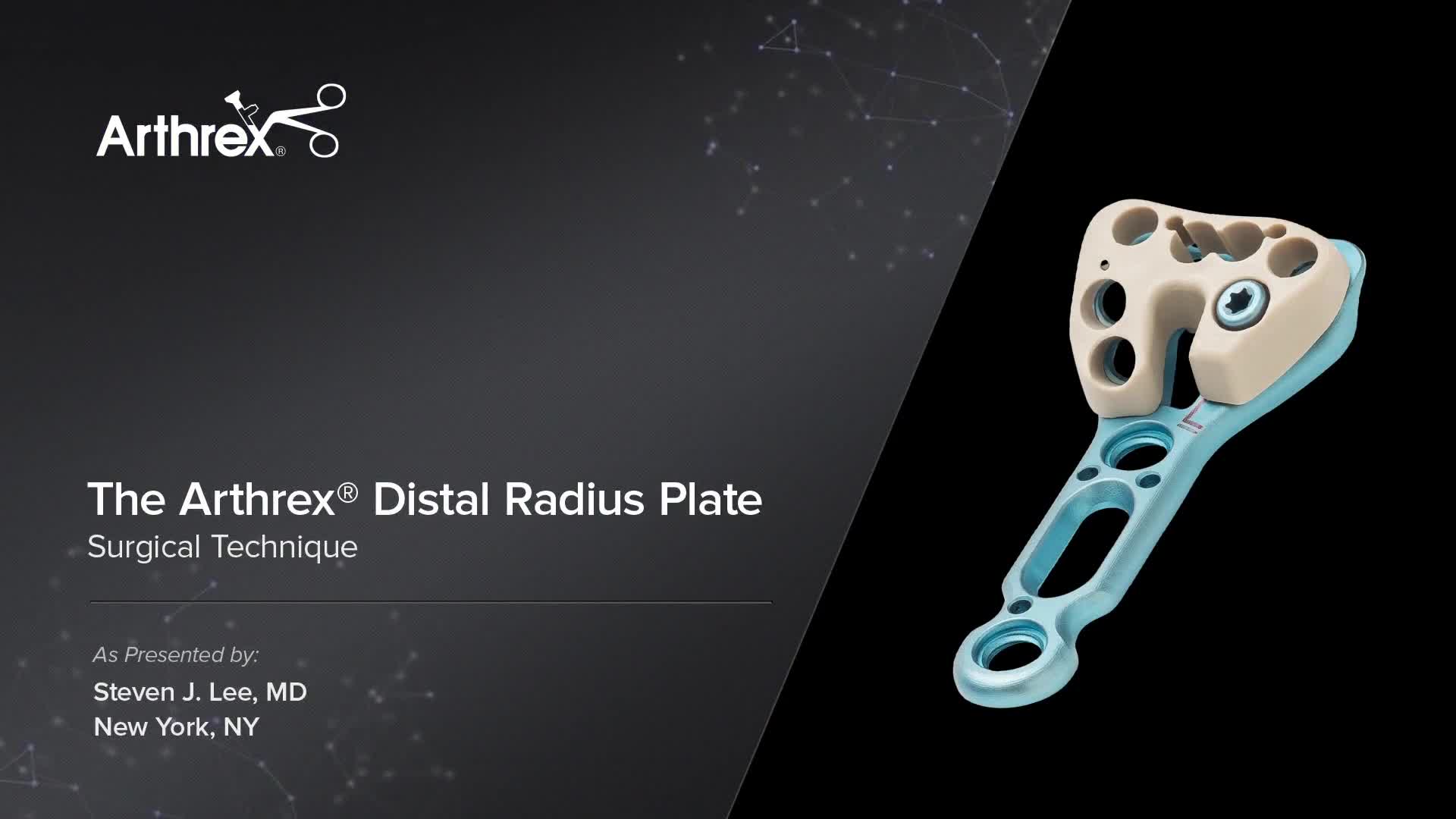 Arthrex Arthrex Distal Radius Plate Surgical Technique