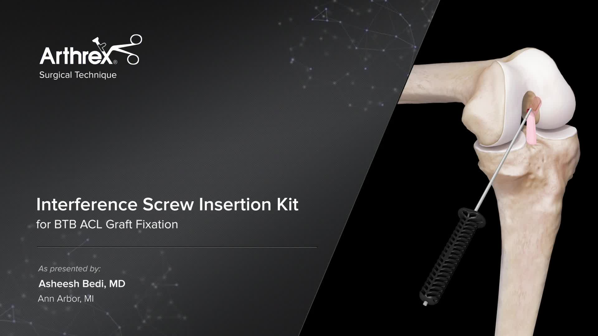 Arthrex Interference Screw Insertion Kit For BTB ACL Graft Fixation