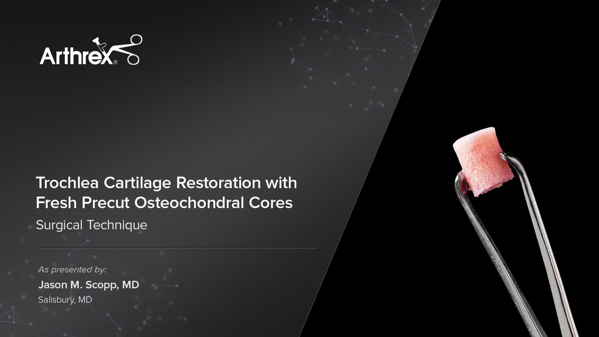 Arthrex Fresh Osteochondral Allografts