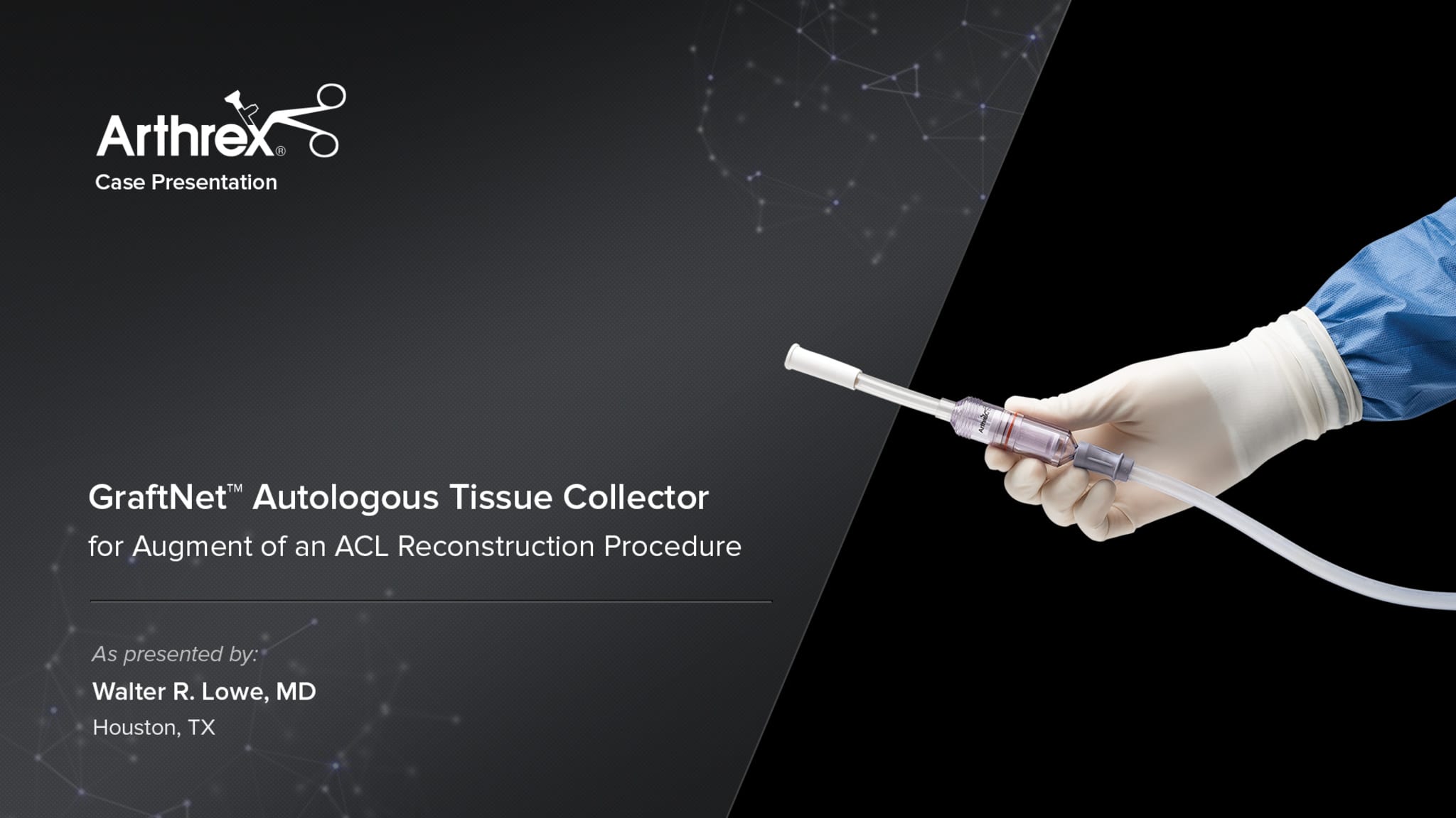 GraftNet™ Autologous Tissue Collector for Augment of an ACL Reconstruction Procedure