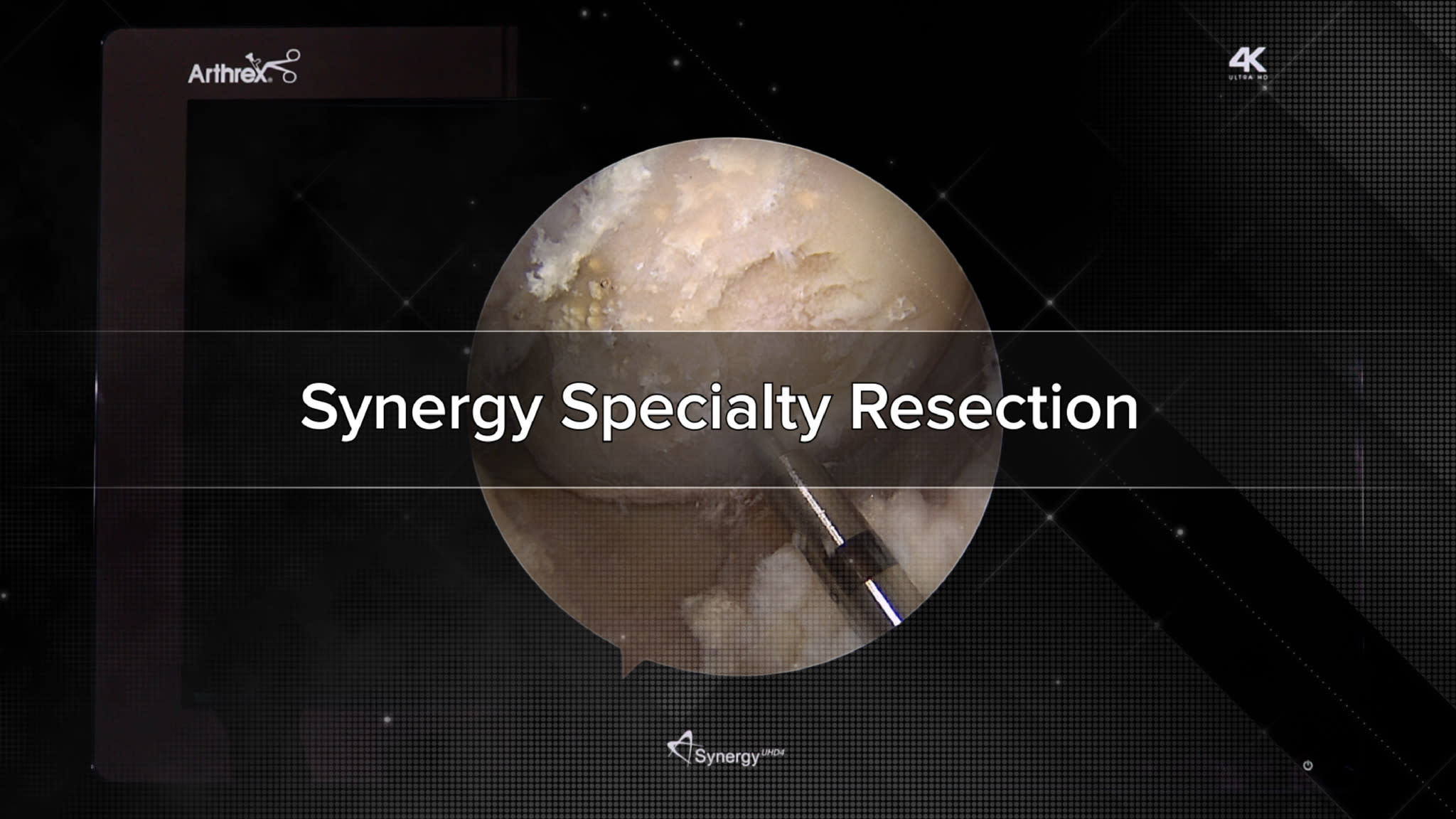 Arthrex Specialty Resection Products Overview