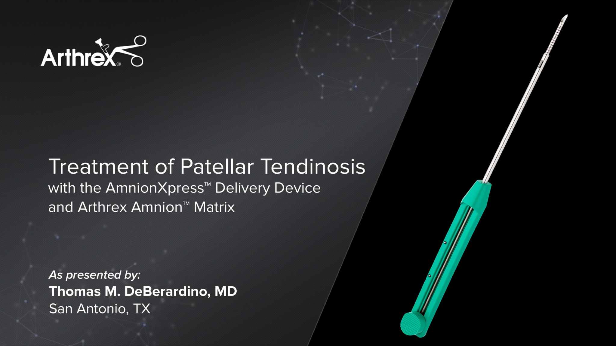 Treatment of Patellar Tendinosis With the AmnionXpress™ Delivery Device and Arthrex Amnion™ Matrix