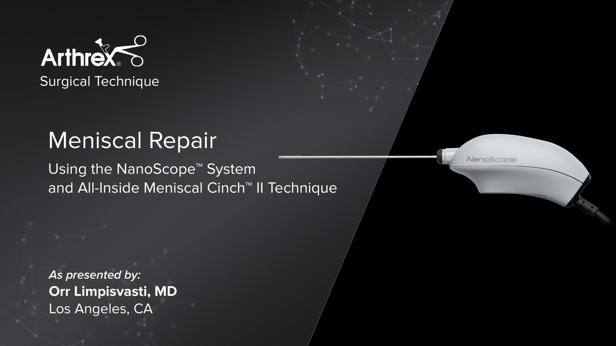Meniscal Repair Using the NanoScope™ System and All-Inside Meniscal Cinch™ II Technique