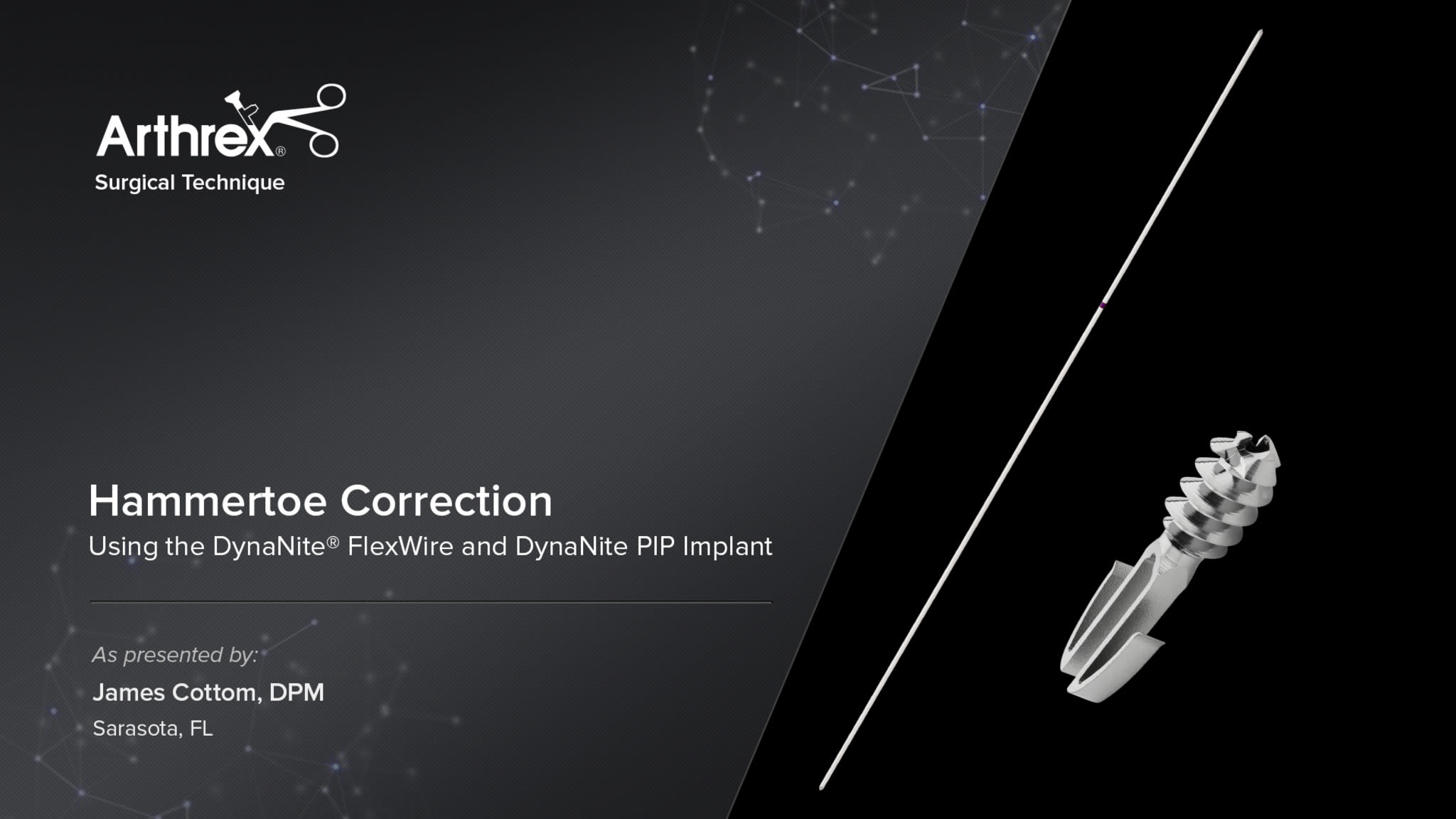 DynaNite® FlexWire and DynaNite PIP Implant for Hammertoe Correction
