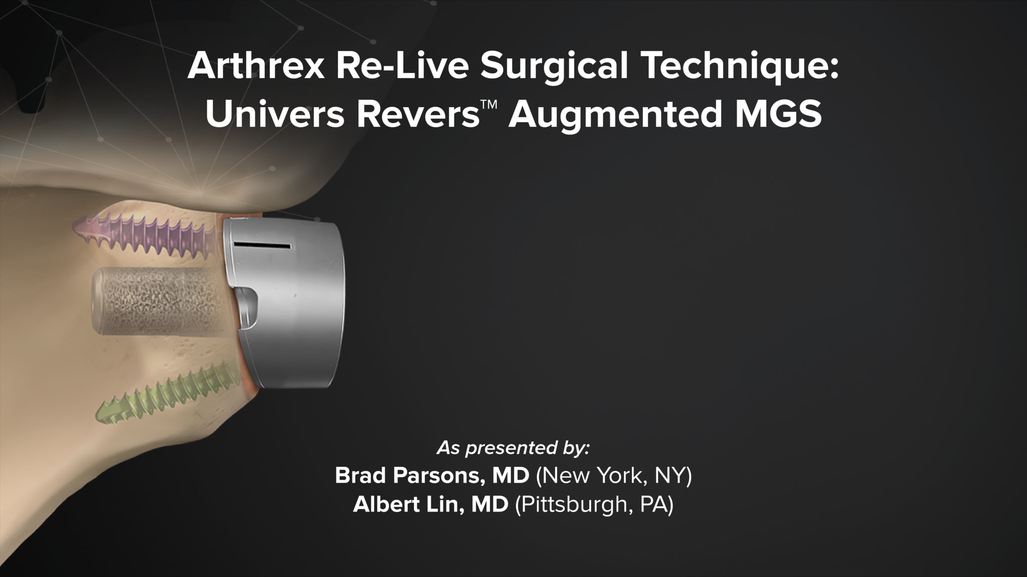 Arthrex Re-Live Surgical Technique: Univers Revers™ Augmented Modular Glenoid System