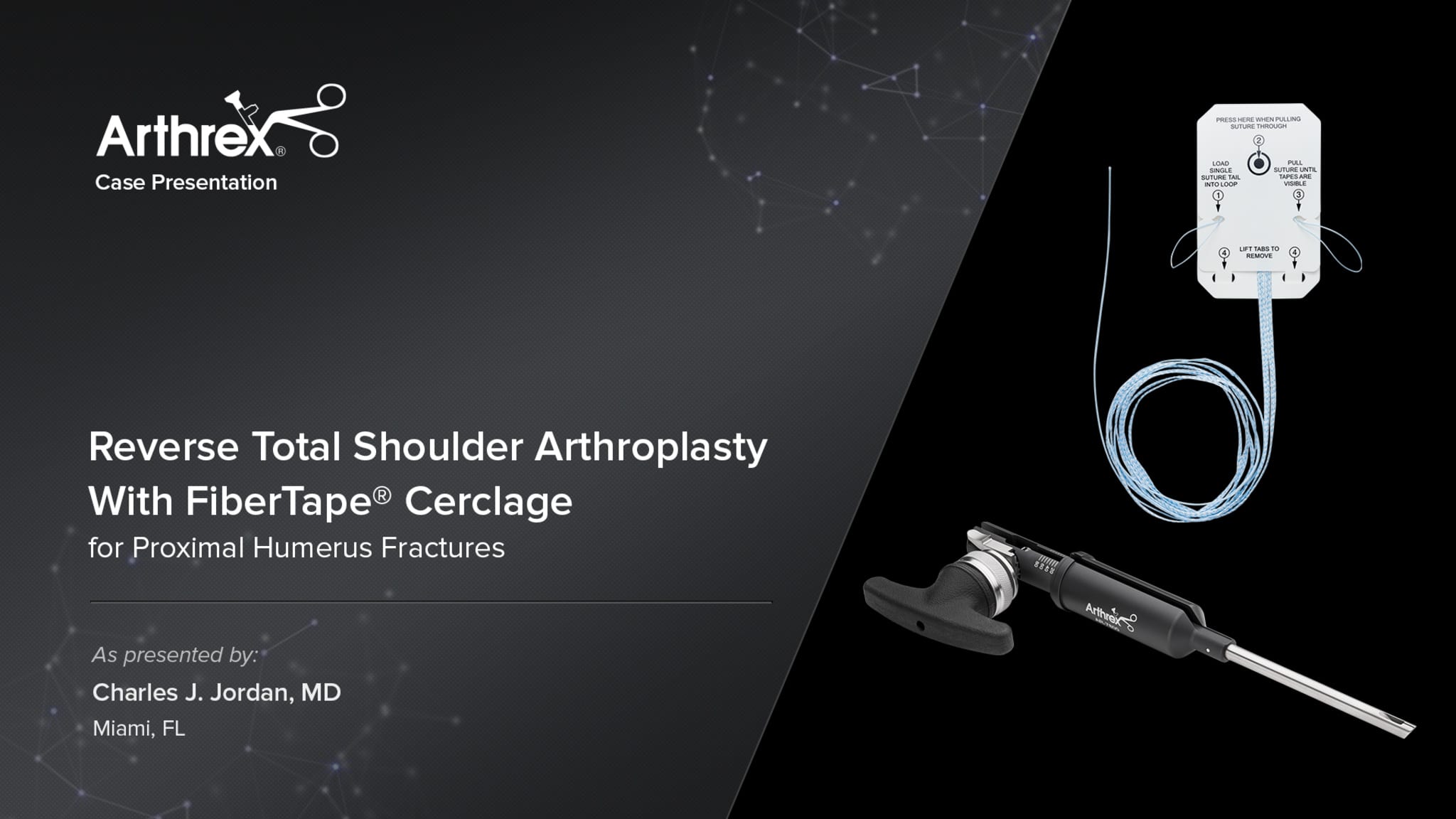 Reverse Total Shoulder Arthroplasty With FiberTape® Cerclage for Proximal Humerus Fractures