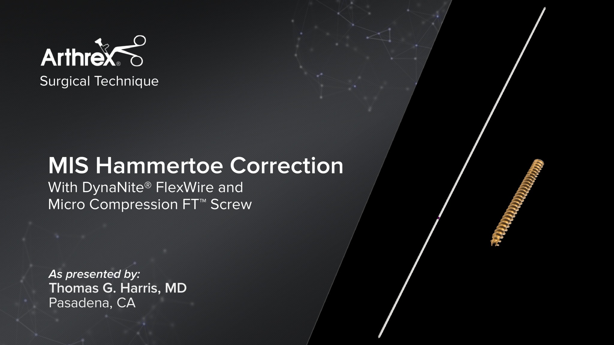 MIS Hammertoe Correction With DynaNite® FlexWire and Micro Compression FT™ Screw