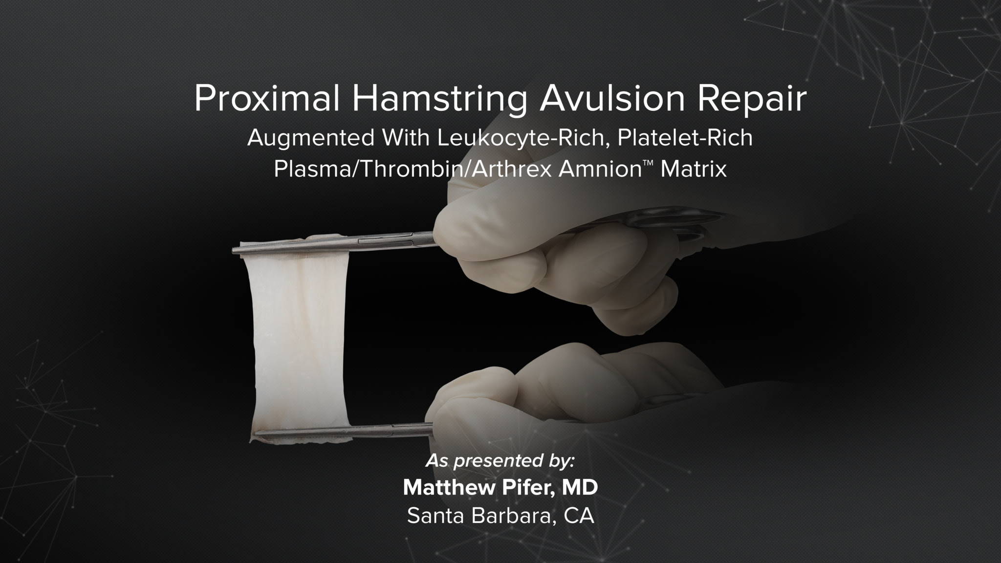 Proximal Hamstring Avulsion Repair Augmented With Arthrex Amnion™ Matrix