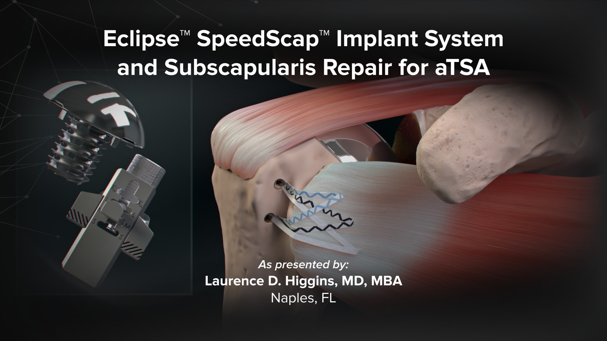 Eclipse™ SpeedScap™ Implant System and Subscapularis Repair for aTSA