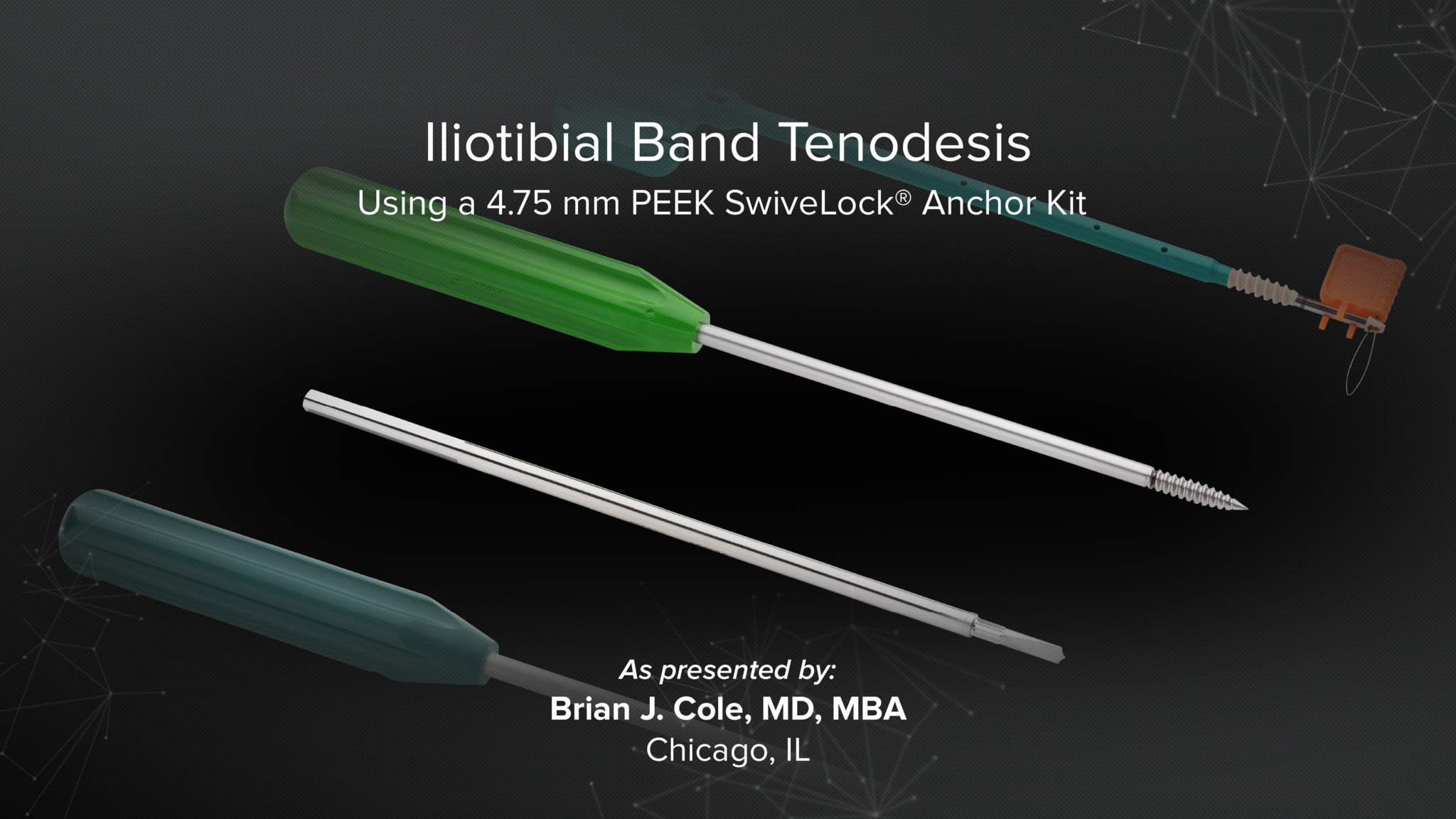 Iliotibial Band Tenodesis Using a 4.75 mm PEEK SwiveLock® Anchor Kit