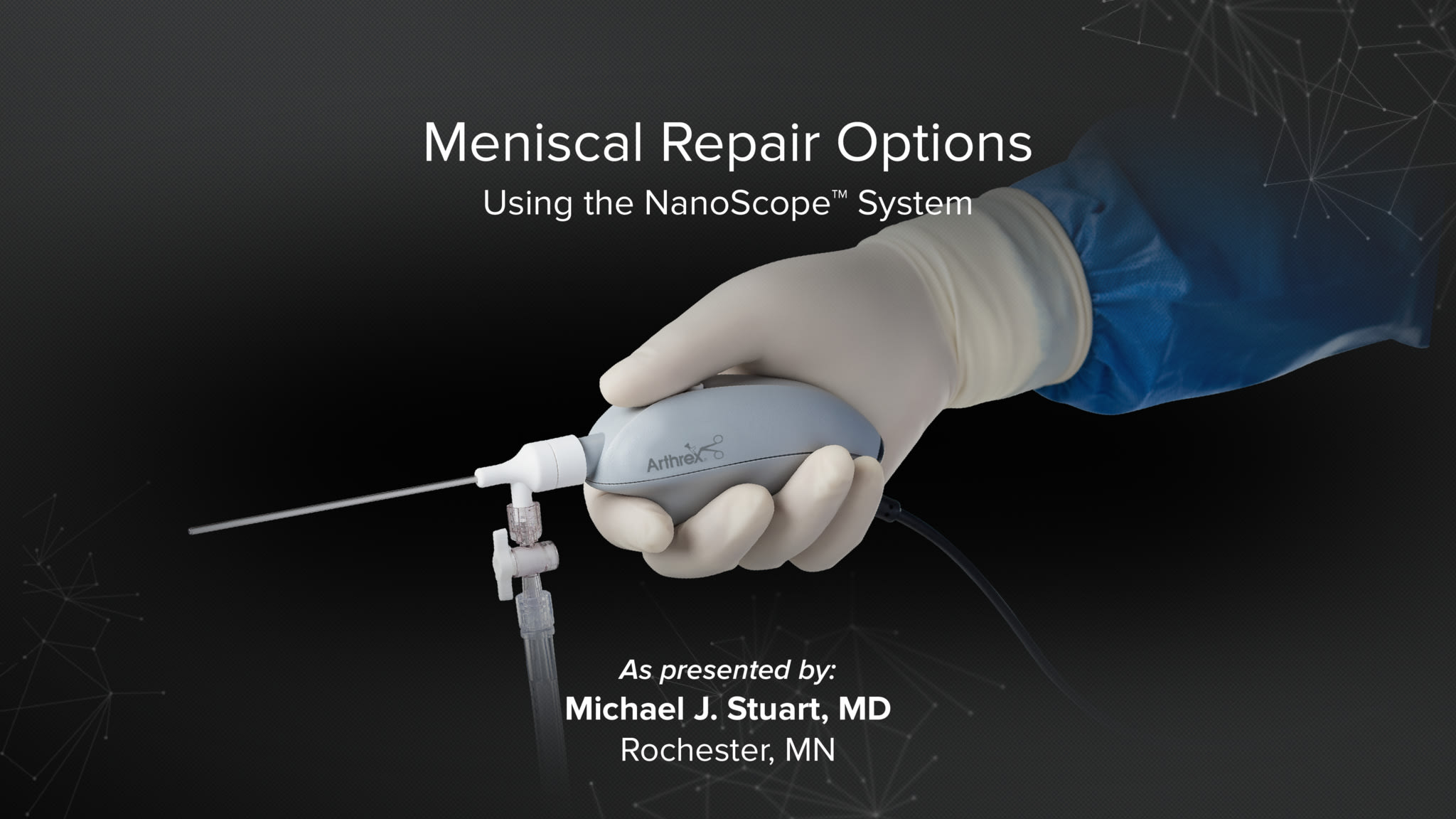 Meniscal Repair Options Using the NanoScope™ System Presented by Dr. Michael J. Stuart at TPC