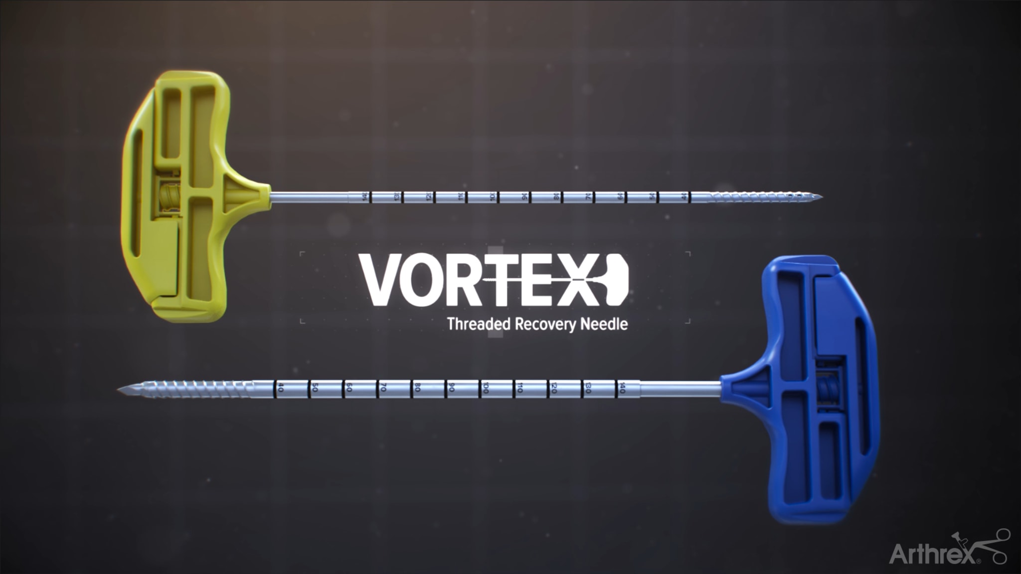 Vortex™ Threaded Bone Marrow Recovery Needle for Aspiration From the Posterior Superior Iliac Spine