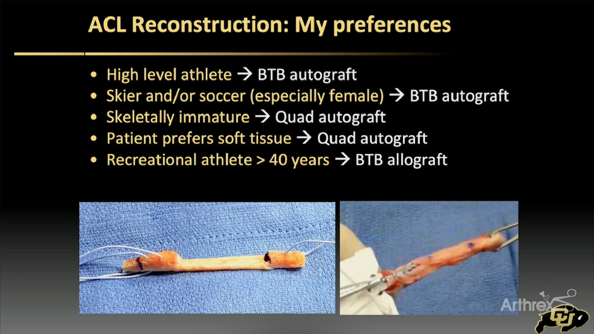 ACL Reconstruction: What Is My Graft of Choice?