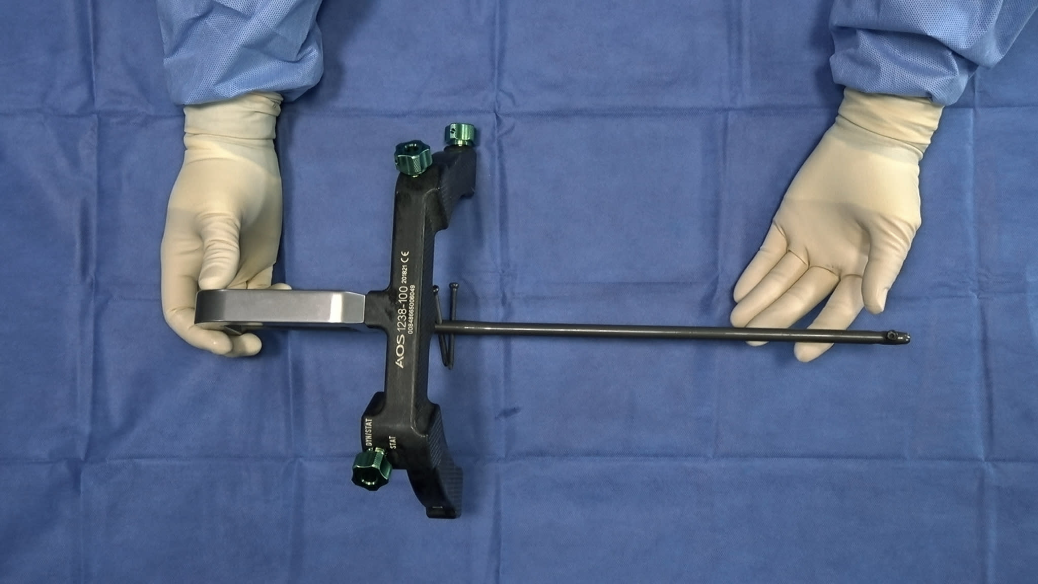Augmentative locking plate with autologous bone grafting for distal femoral  nonunion subsequent to failed retrograde intramedullary nailing - Ru et al.  2016a - Scipedia