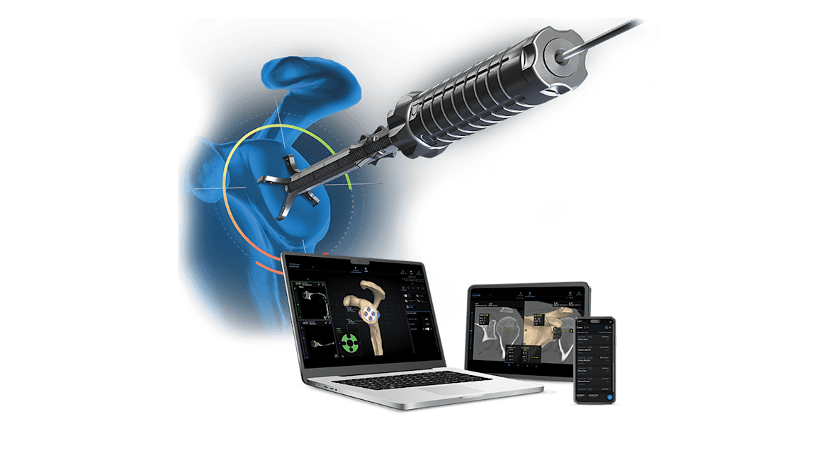 Sistema Virtual Implant Positioning<sup>™</sup> (VIP<sup>™</sup>)