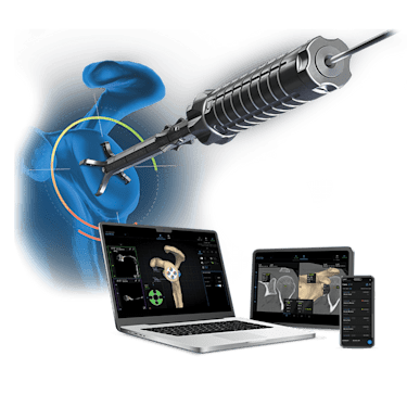 Sistema Virtual Implant Positioning<sup>™</sup> (VIP<sup>™</sup>)