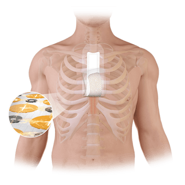 JumpStart<sup>®</sup> Antimicrobial Wound Dressing