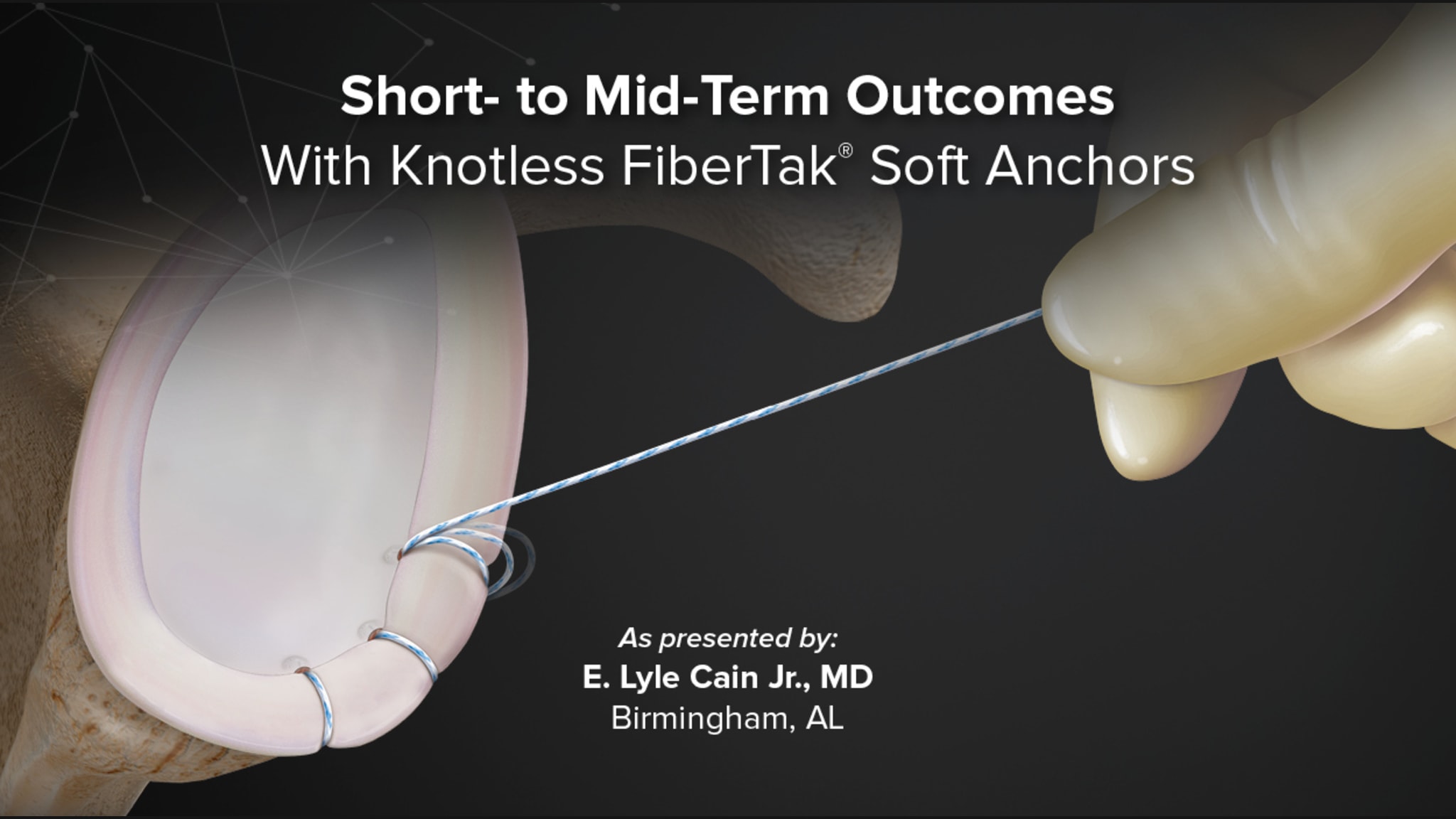 Short- to Mid-Term Outcomes With Knotless FiberTak® Soft Anchors