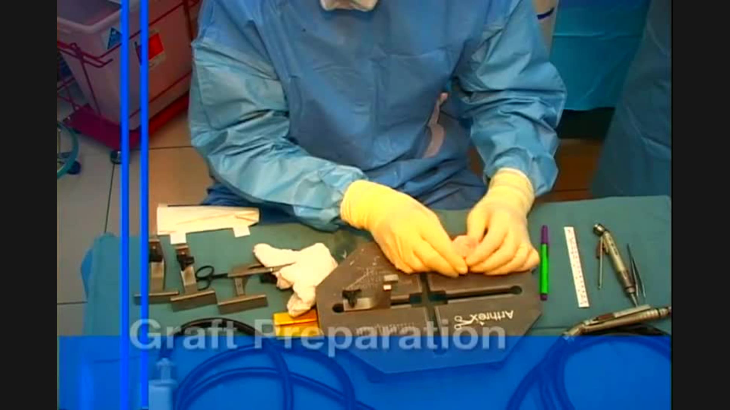 Dovetail Technique for Lateral Meniscal Allograft Transplantation
