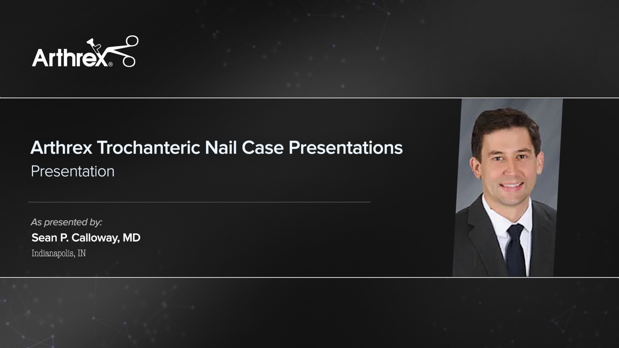 Arthrex Trochanteric Nail Case Presentations