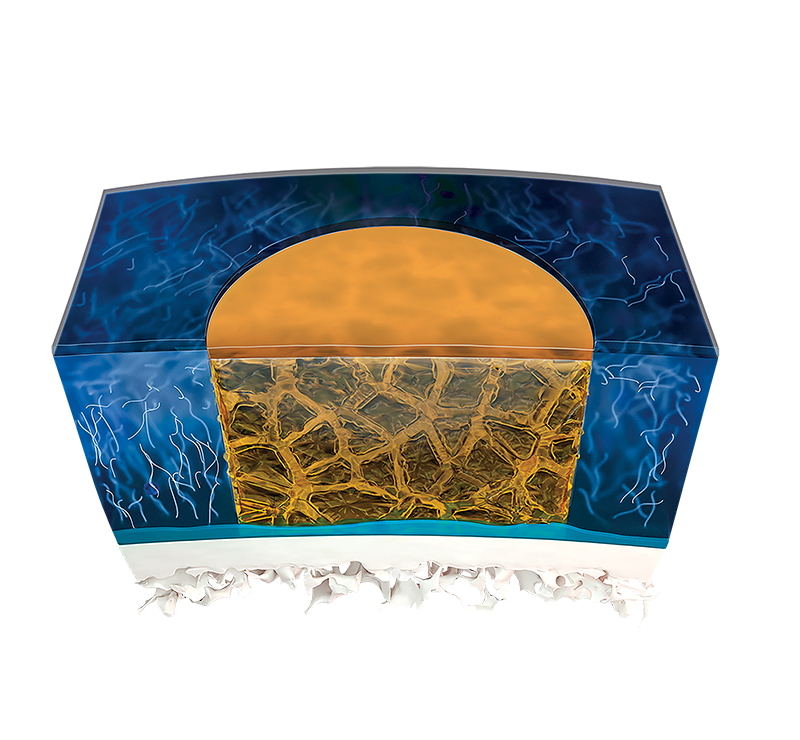 Arthrex Cartilage Repair