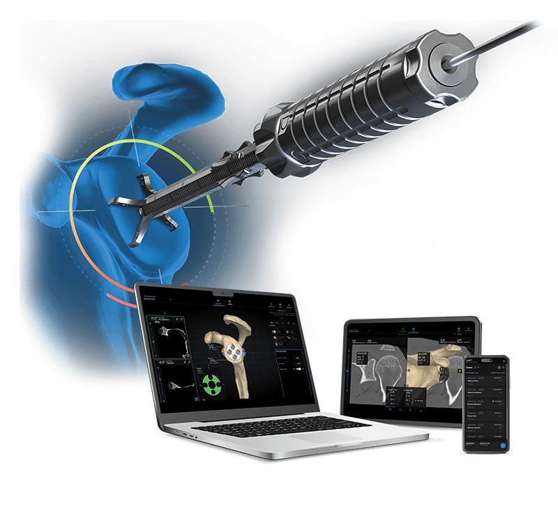 Virtual Implant Positioning™ (VIP) - Sistema de posicionamiento virtual de implantes