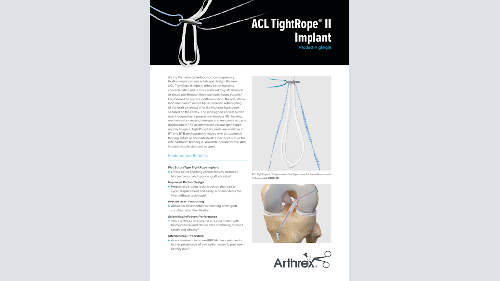 ACL TightRope® II  Implant