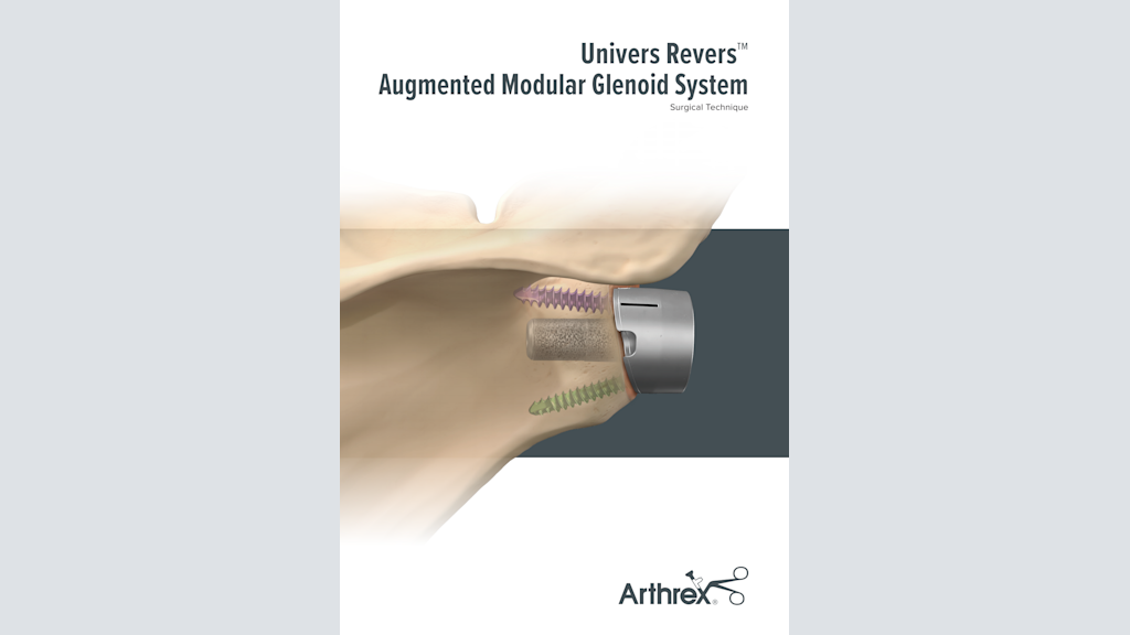 Univers Revers™   Augmented Modular Glenoid System