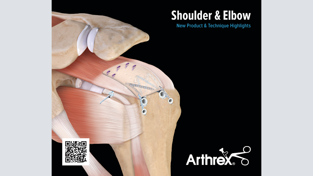 Shoulder & Elbow New Product & Technique Highlights