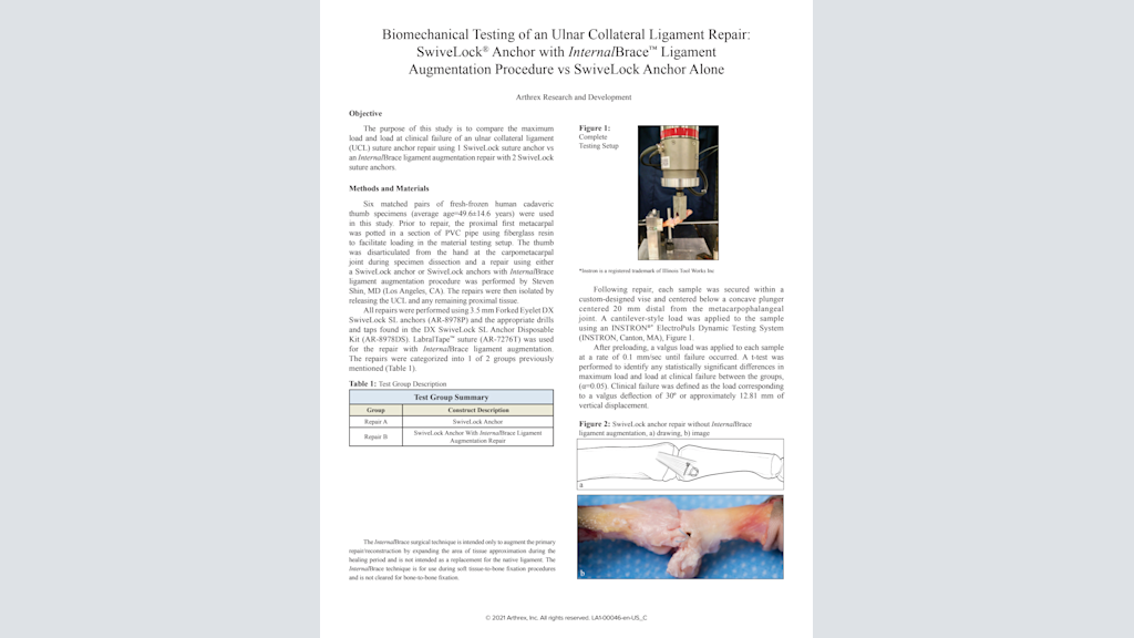 Biomechanical Testing of an Ulnar Collateral Ligament Repair: SwiveLock® Anchor with InternalBrace™ Ligament Augmentation Procedure vs SwiveLock Anchor Alone