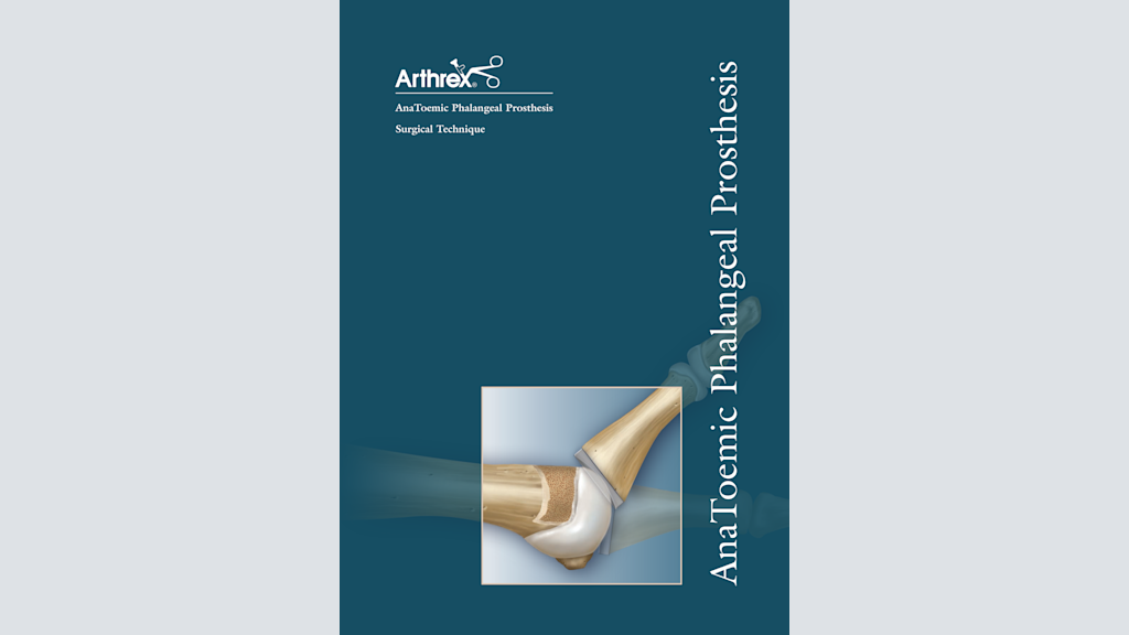 AnaToemic ® Phalangeal Prosthesis
