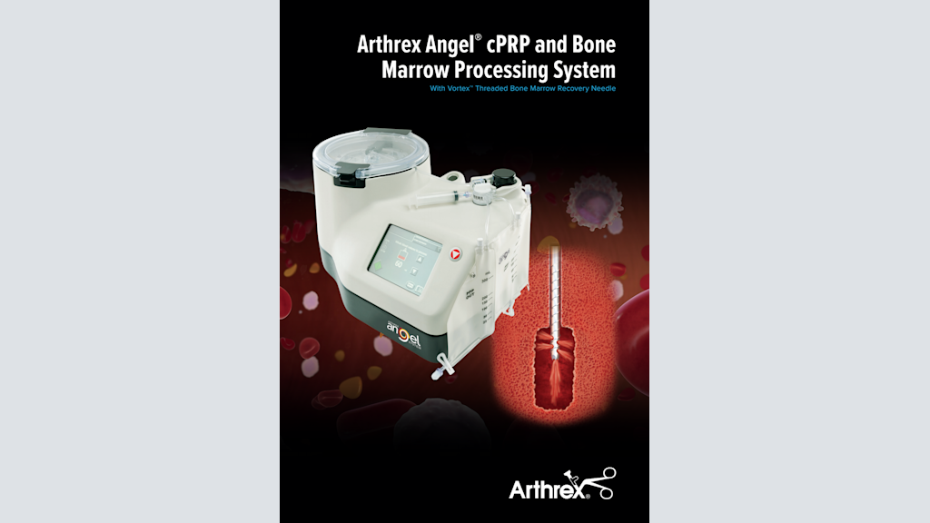 Arthrex Angel® cPRP and Bone Marrow Processing System With Vortex™ Threaded Bone Marrow Recovery Needle