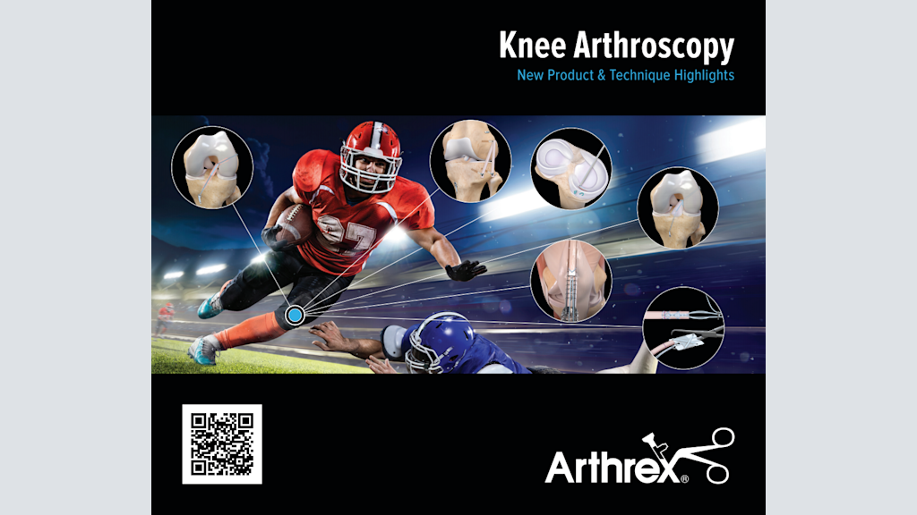 Knee Arthroscopy New Product & Technique Highlights
