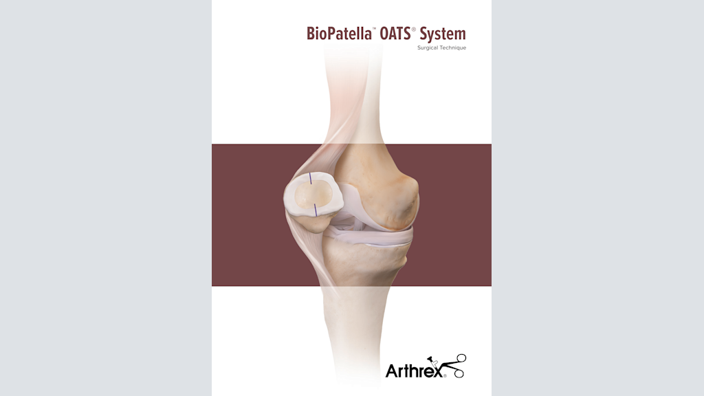 BioPatella™ OATS® System