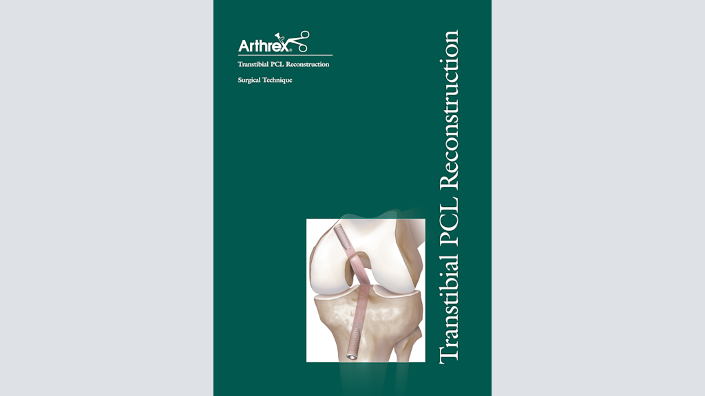Arthrex Pcl Reconstruction – Arthrex – CVVI