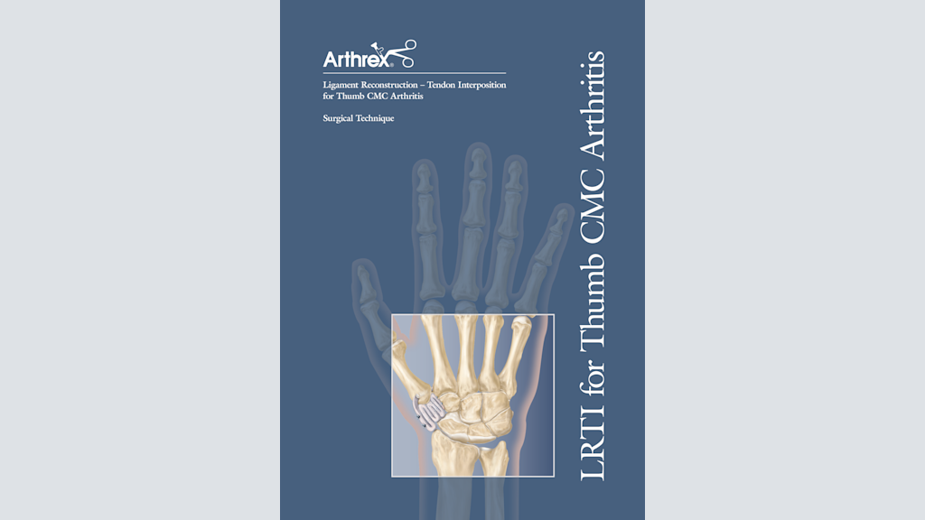 Ligament Reconstruction - Tendon Interposition for Thumb CMC Arthritis