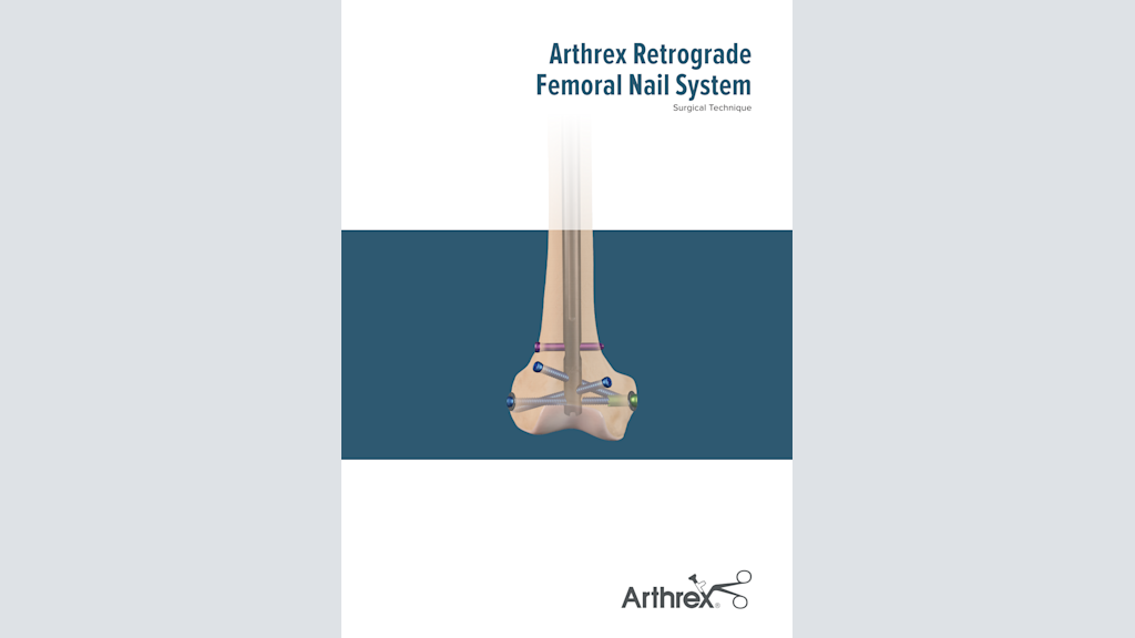 Arthrex Retrograde Femoral Nail System