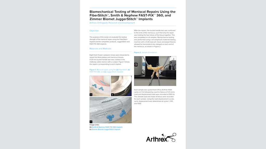 Biomechanical Testing of Meniscal Repairs Using the FiberStitch™, Smith & Nephew FAST-FIX™ 360, and Zimmer Biomet JuggerStitch™ Implants